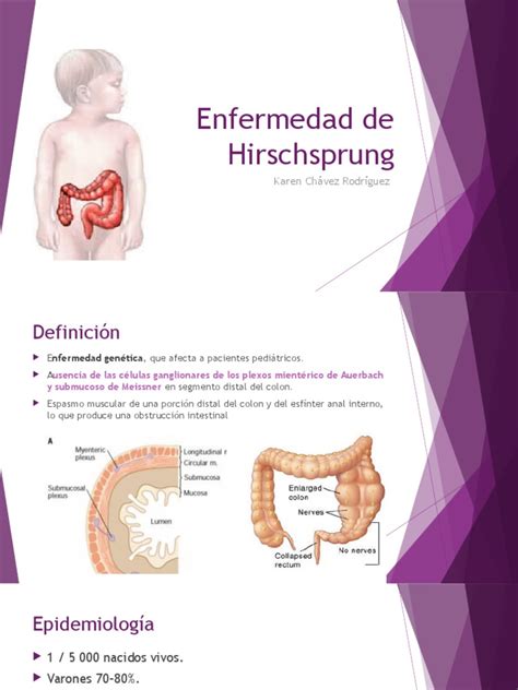 enfermedad de hirschsprung-1